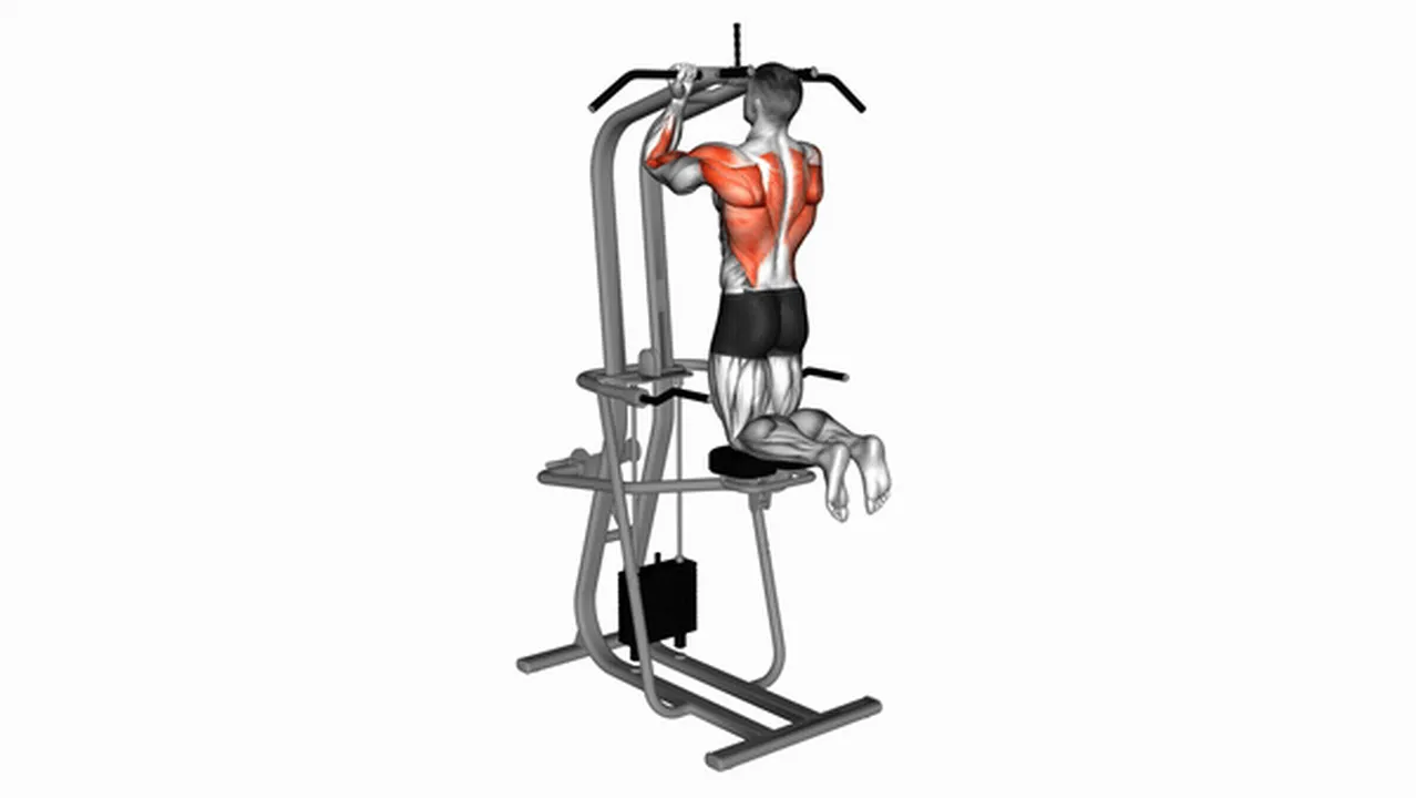 What are the benefits of Lever Assisted Chin-Ups? Image