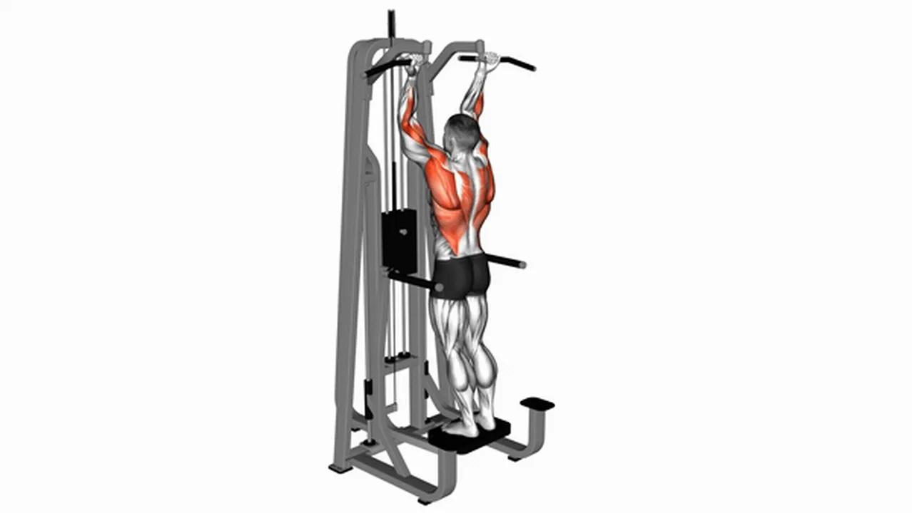 What are the benefits of Lever Assisted Standing Chin-Ups? Image